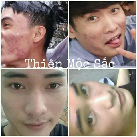 [HCM]Thiên Mộc Sắc dòng tiêu chuẩn 30ml 50ML 100ML