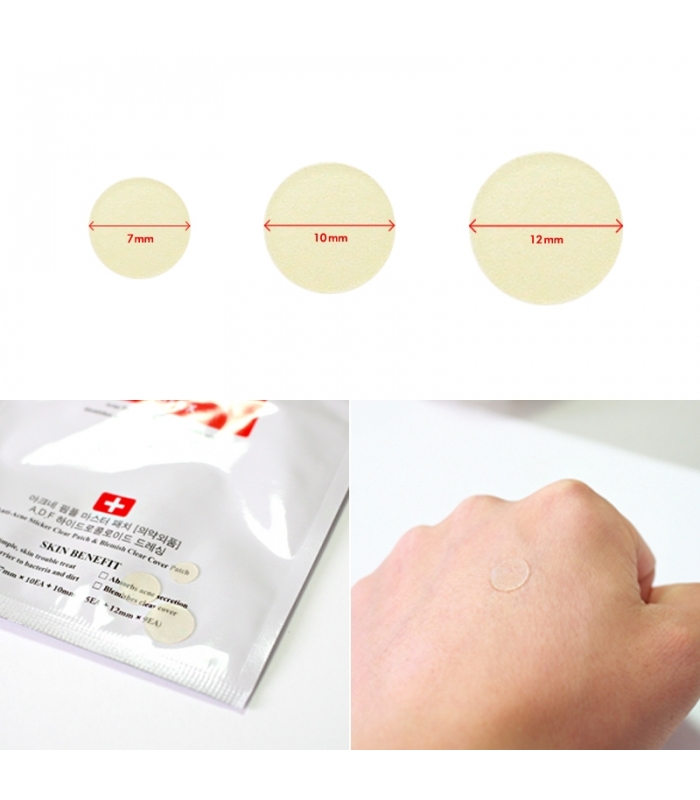 Miếng dán mụn Cosrx Acne Pimple Master Patch che mụn giảm sưng