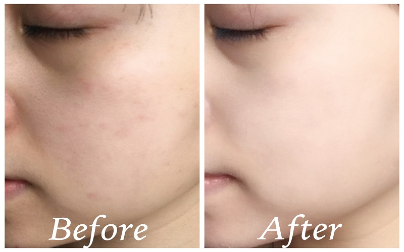 Phấn Phủ Shiseido Baby Powder Pressed 50g