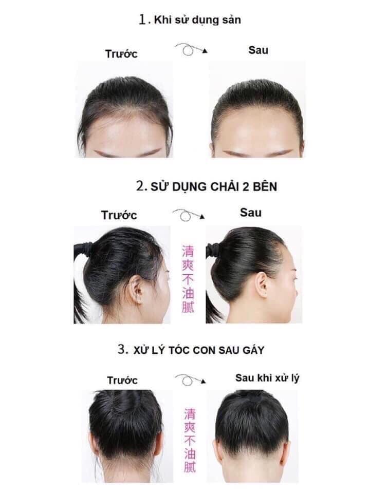 Combo 2 Bộ Chuốt Tóc Con Giữ Nếp Gọn Gàng Mái Tóc