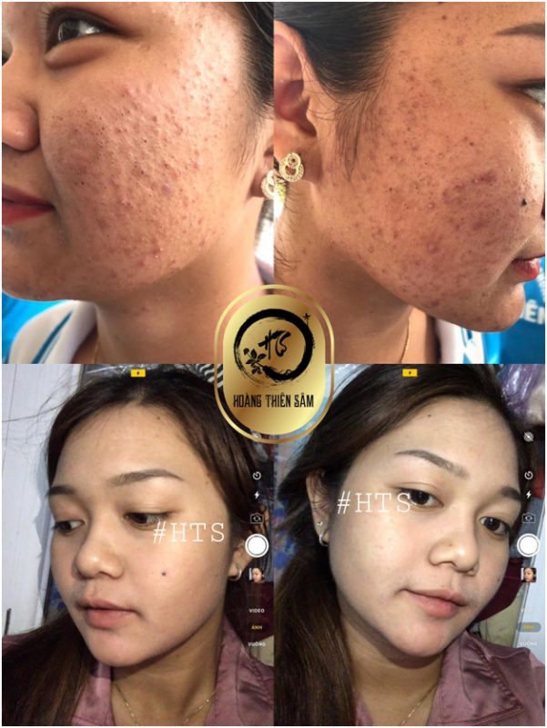 [HCM]Bọt Rửa Mặt Thảo Dược Hoàng Thiên Sâm