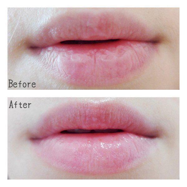 [HCM]SON DƯỠNG MÔI BLISTEX SPF15