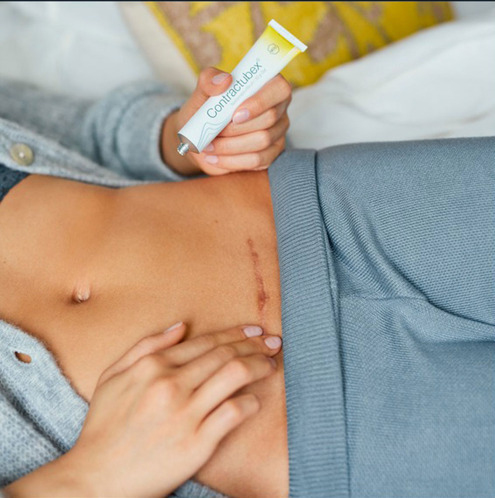 Kem Sẹo Contractubex Nội Đia Ba Lan 20g