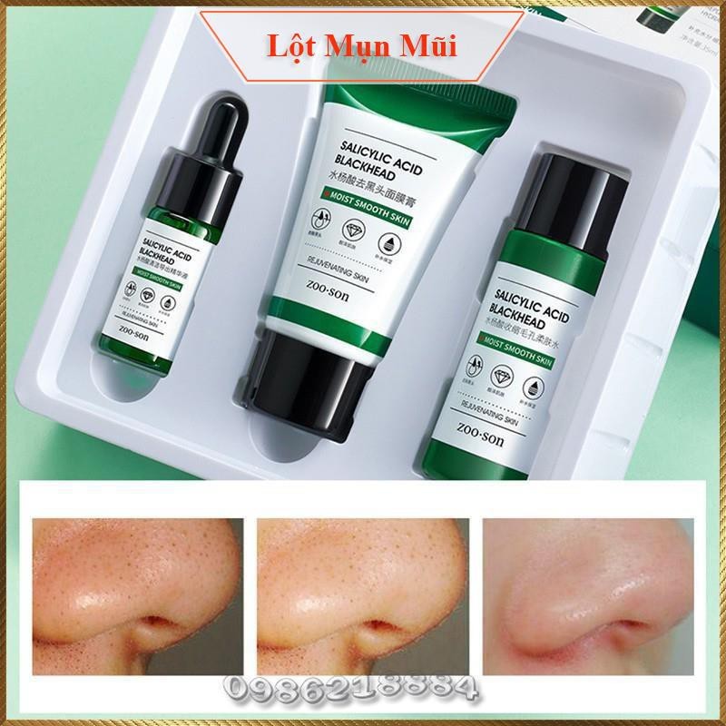 Bộ 3 sản phẩm lột mụn đầu đen Zoo Son Salicylic Acid Blackhead Care Set thu nhỏ lỗ chân lông BZB3 giá rẻ