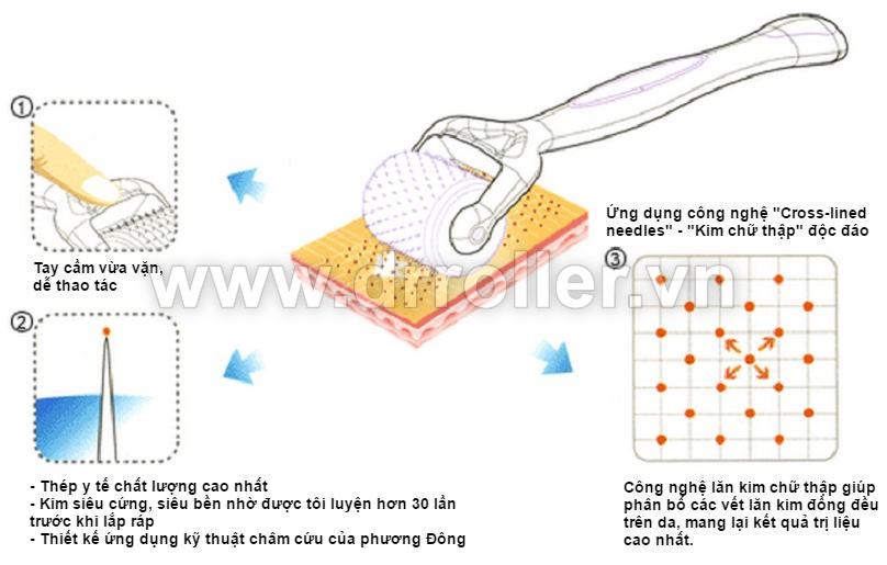 Kim lăn Dr. Roller 1.0mm 192 đầu kim