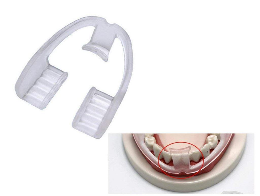 [HCM]Dụng cụ chống nghiến răng và bảo vệ răng miệng#CNN