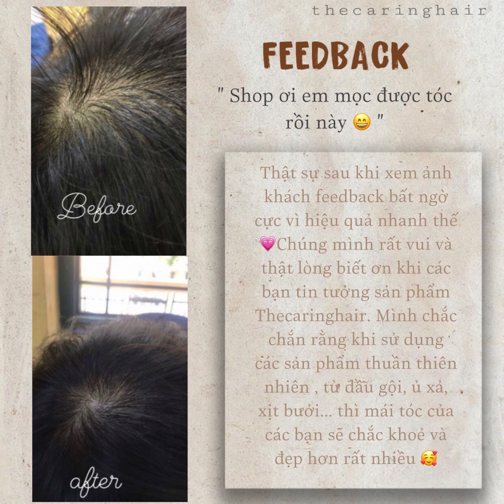 Xịt Tóc Tinh Dầu Bưởi The Caring Hair ( Kích Mọc Tóc - Giảm Rụng )