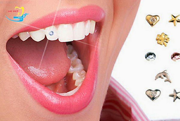 [HCM]Keo đính đá 10g [Loại Lớn]