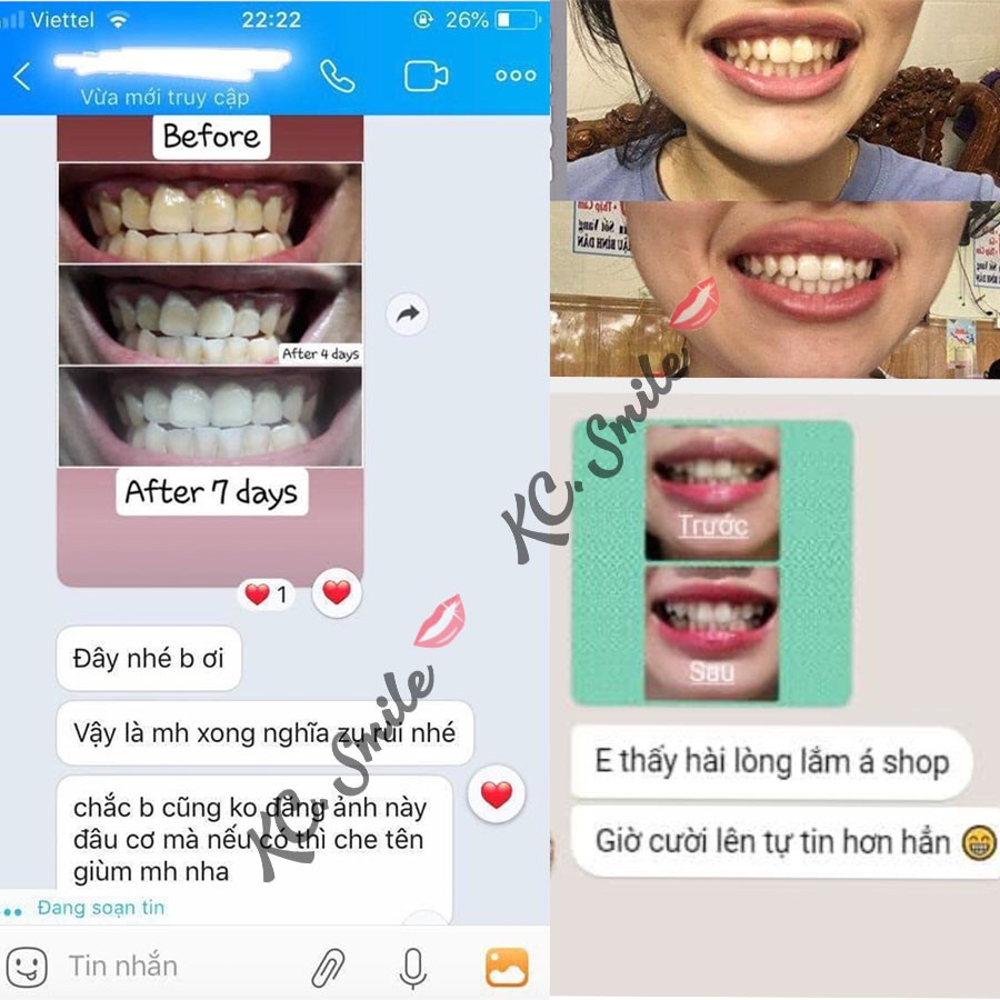 Combo trắng răng Miếng dán trắng răng Crest Professional + Kem đánh răng Crest 3D (7 ngày)