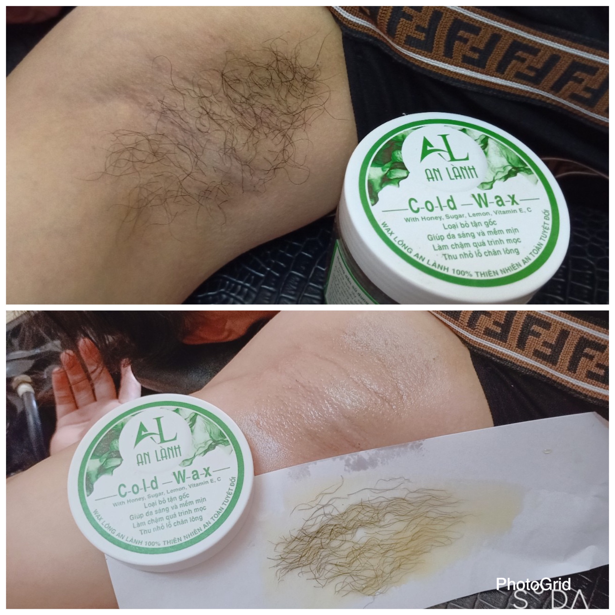 Combo Wax Lông Và Mỡ Trăn An Lành Chính Hãng