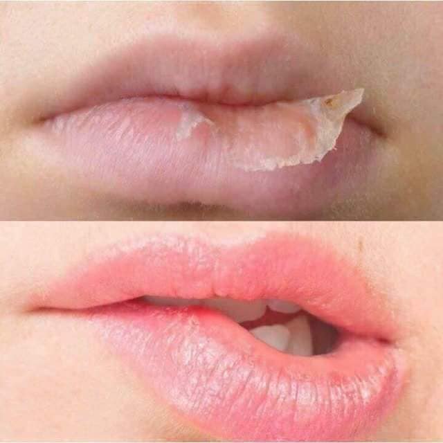 [TPHCM]-Dưỡng môi Vaseline Lip Therapy 20G (Phiên bản nội địa Nhật)