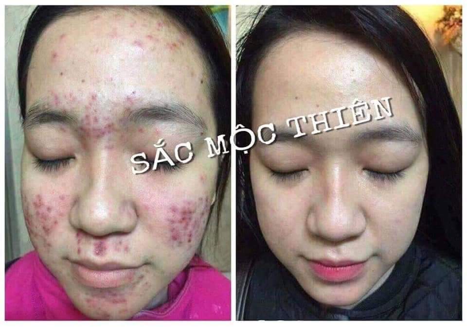 Sắc mộc thiên