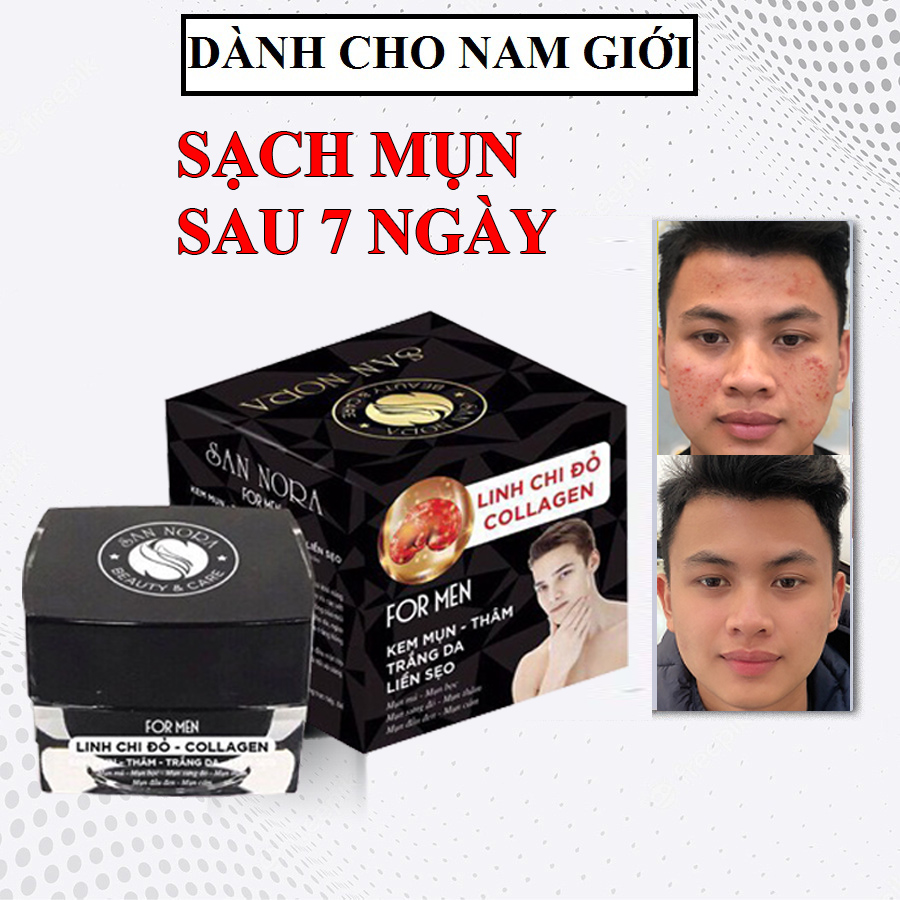 Kem mụn dành cho nam giới xóa thâm trắng da liền sẹo dưỡng chất Linh Chi Đỏ và Collagen Sannora FOR MEN 20g
