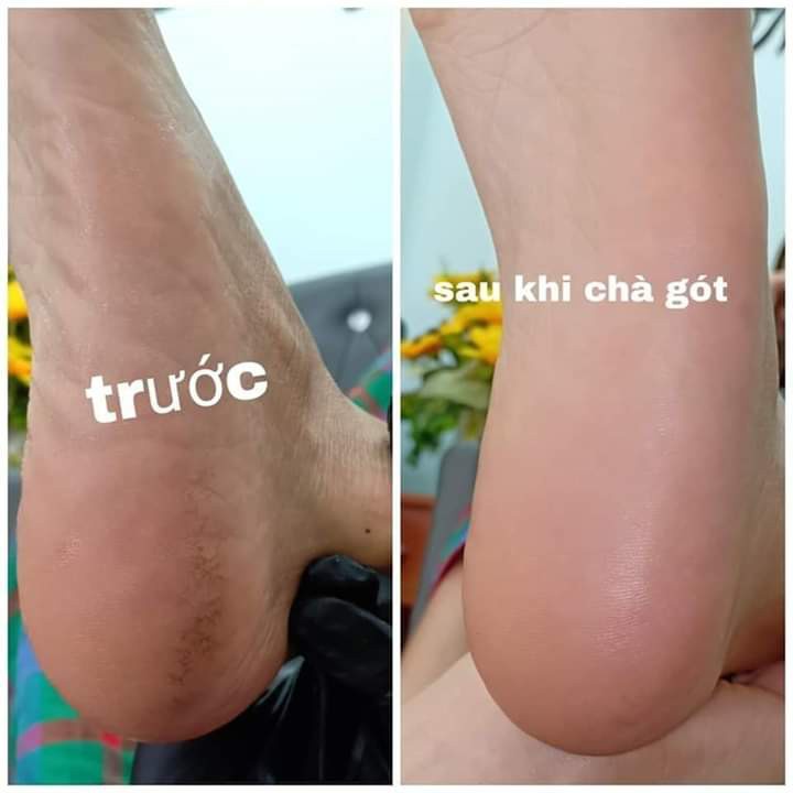 Chà gót chân , dụng cụ chà gót chân Inox