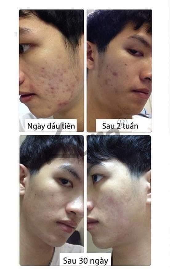Tinh Chất Sâm Đất