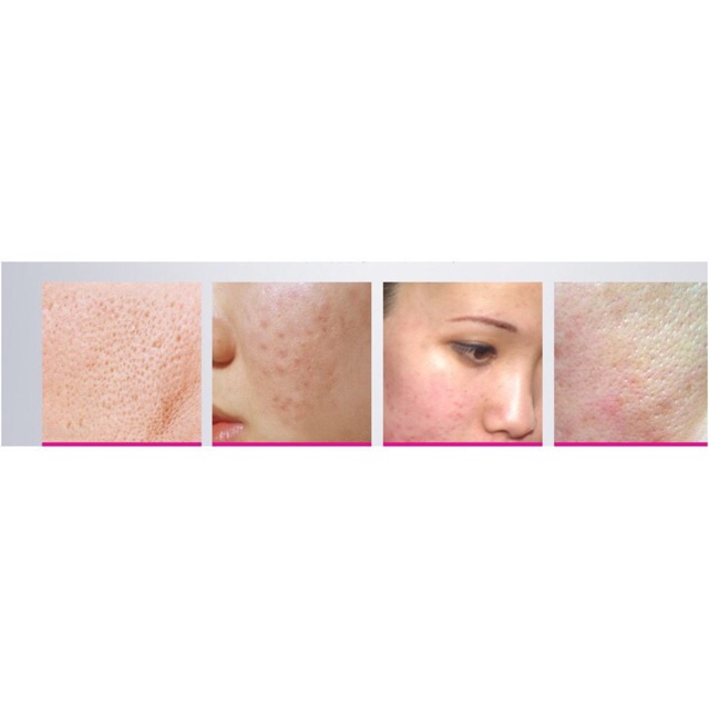 [HCM]Sữa Rửa Mặt Đặc  Mụn Kiềm Dầu Bioaqua