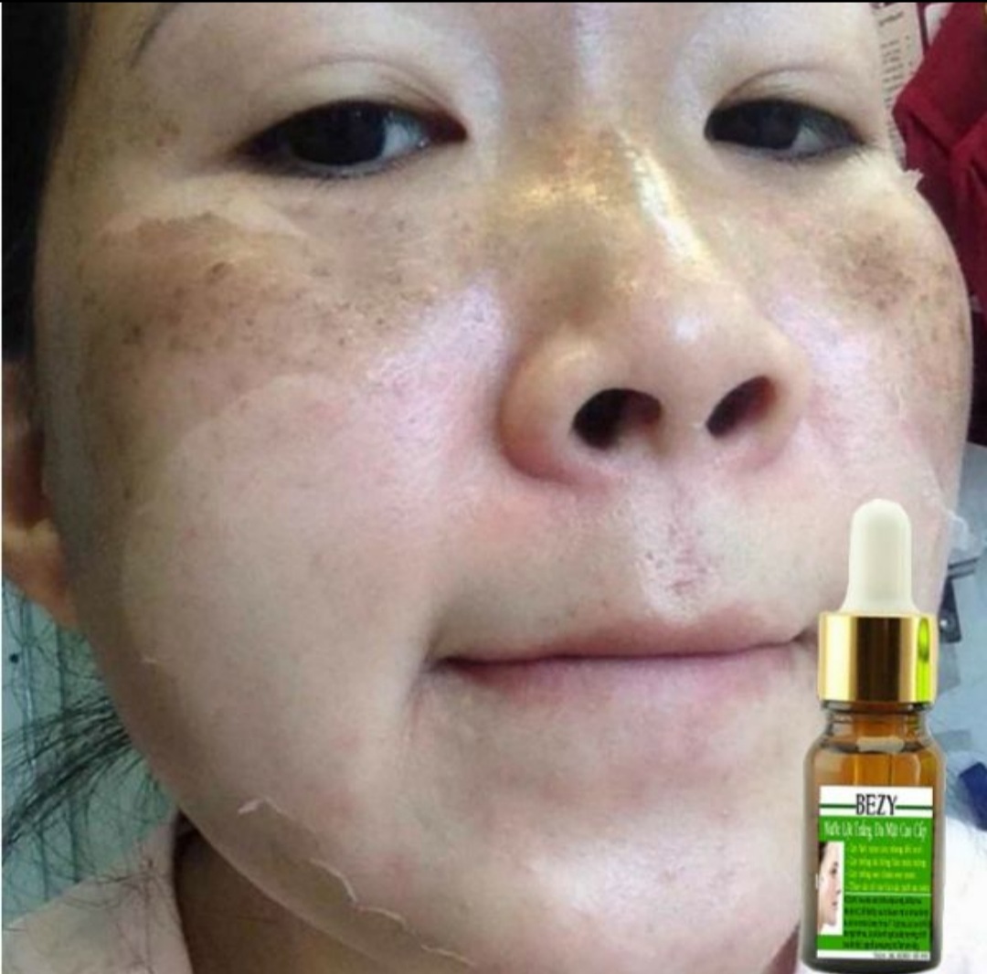 Bộ Peel Da Mặt & Kem Trắng Da Collagen