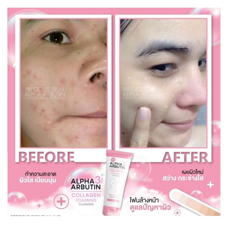 Sữa rửa mặt trắng da Alpha Arbutin Foaming Cleanser 120ml