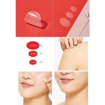 Miếng dán mụn Cosrx Acne Pimple Master 24 patches