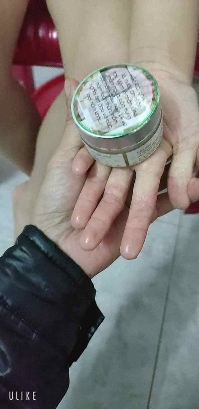 VIÊM DA TRẦN KIM HUYỀN
