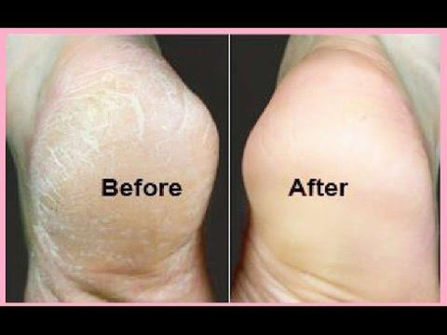 [HCM]ĐÁ BỌT CHÀ GÓT CHÂN KÈM BÀN CHẢI CHÀ MÓNG
