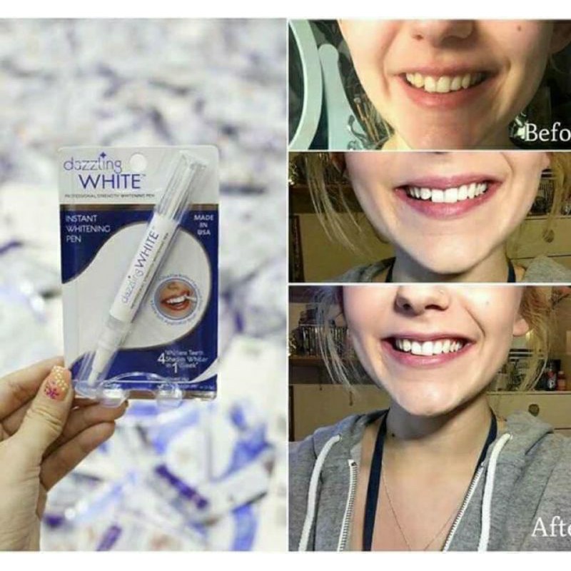 Bút .T.ẩ.y. Trắng Răng DAZZING WHITE
