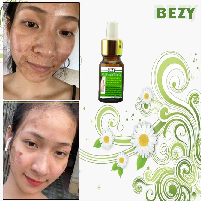 [HCM]Bộ Peel Trắng Da Mặt Tái Tạo Da