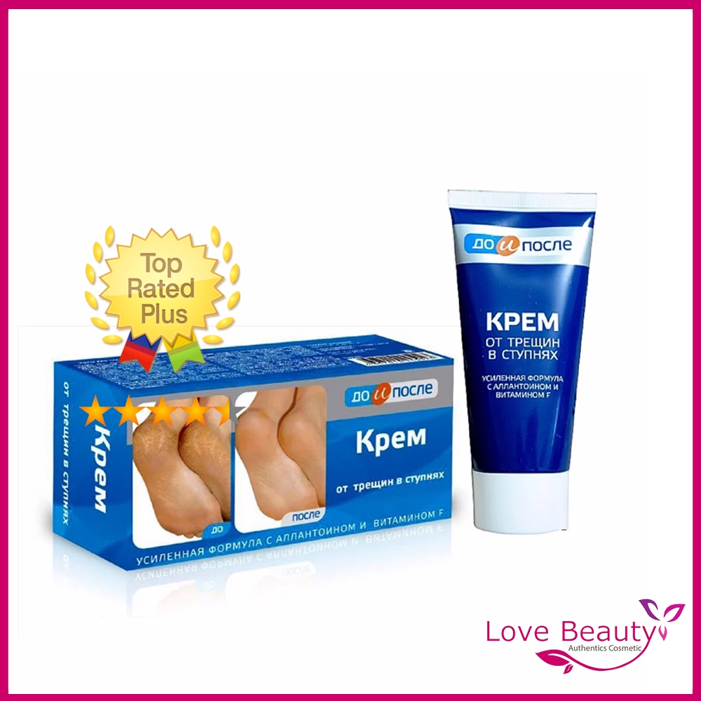 Kem Nứt Nẻ Gót Chân Nga Kpem