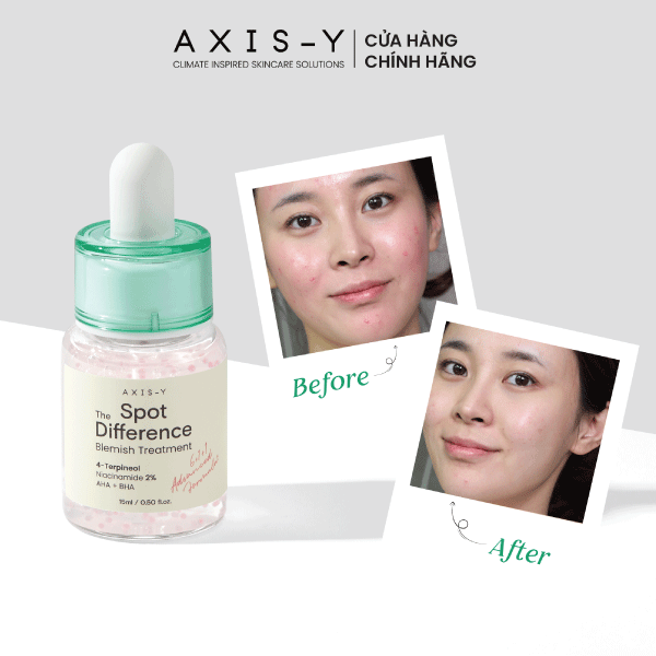 Combo serum dưỡng sáng mờ thâm và tinh chất chấm mụn 65ml