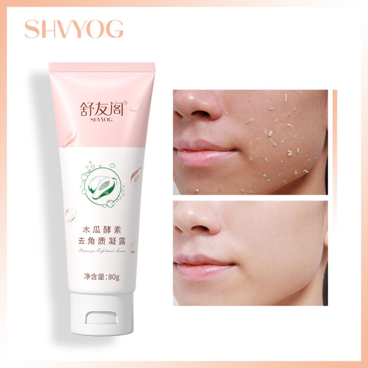 SHVYOG Kem Tẩy Tế Bào Chết Mặt Kem Dưỡng Ẩm Làm Trắng Tẩy Mụn Đầu Đen Điều Trị Mụn Trứng Cá Chăm Sóc Da Mặt 80g