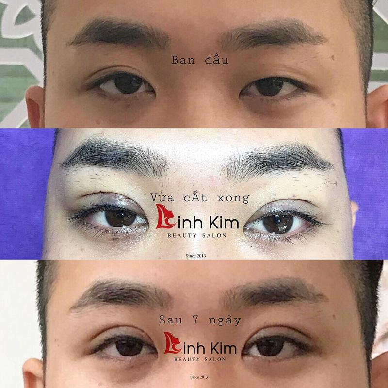 Máy Nhấn Mí Plasma Hàn Quốc