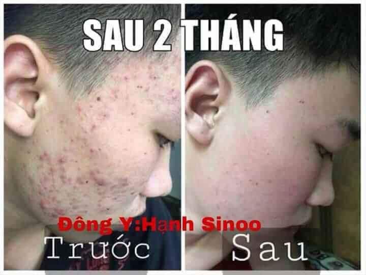SÂM LINH DƯỢC HẠNH SINOO(CỐT SÂM)