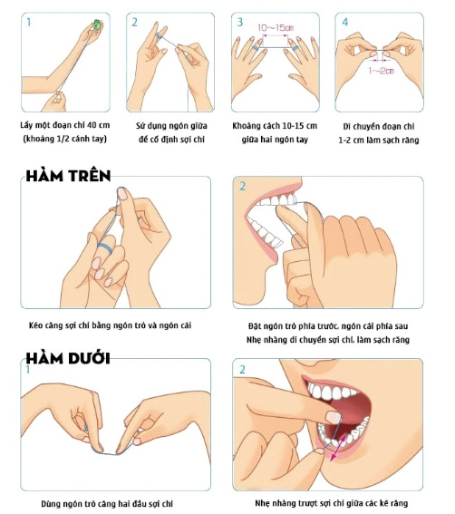 Chỉ Nha Khoa Oral - Oraltana