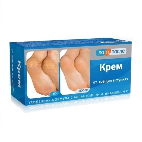 Kem xóa nứt nẻ, dưỡng gót chân Apteka Nga