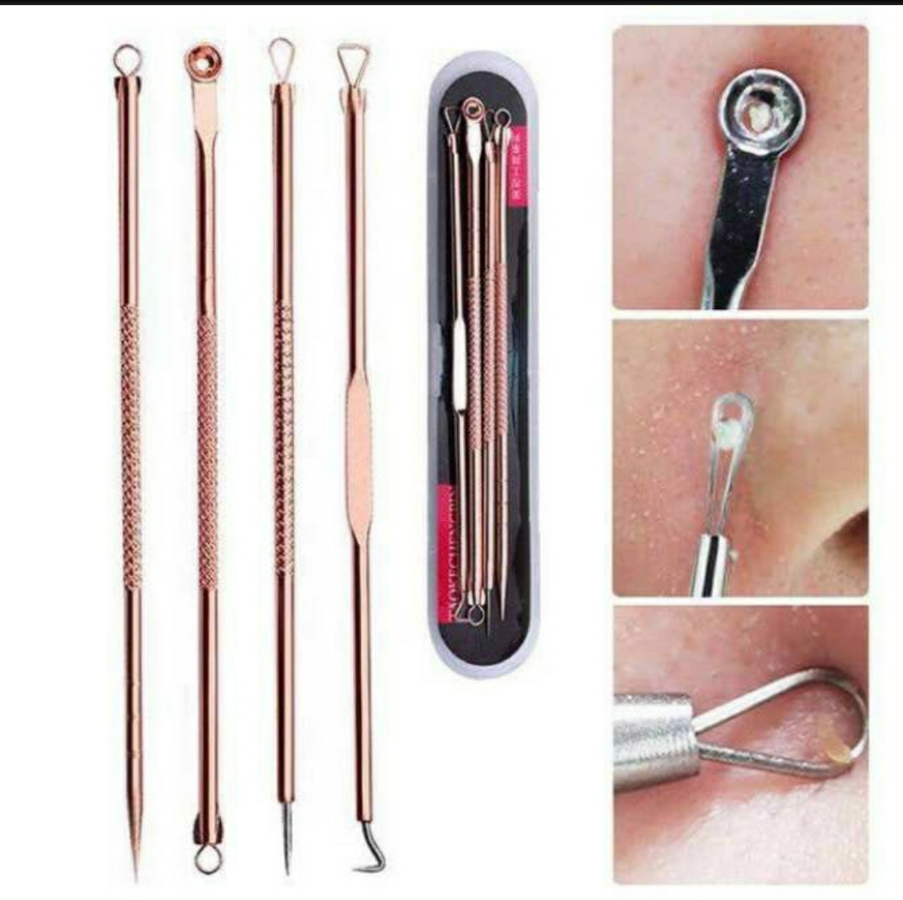 ( SALE ) Bộ 4 cây nặn mụn đầu đen, mụn trứng cá thần thánh, thiết kế nhỏ gọn, bền, an toàn khi sử dụng