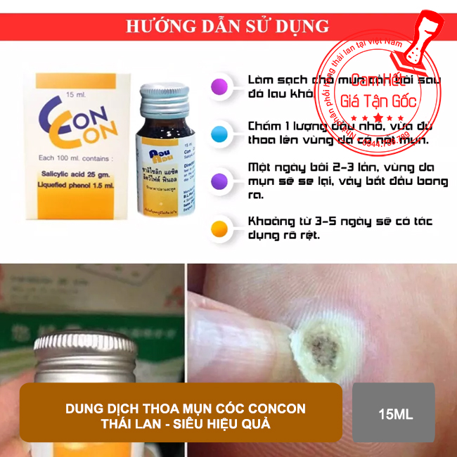 01 chai Dung dịch thoa giảm Mụn Cóc Concon Thái Lan 15ml