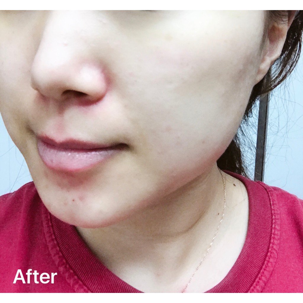 Nước hoa hồng Eclado – Ginseno Triple Essential Toner (150ml)