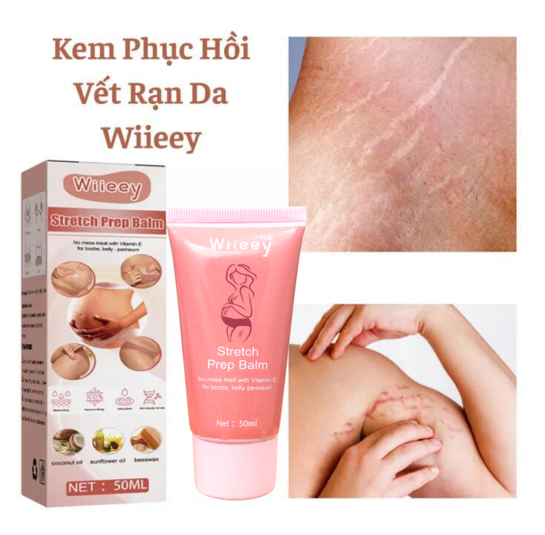 Kem Trị Rạn Da Sau Sinh Cho Bà Bầu Wiieey Cải Thiện Nếp Nhăn, Phục Hồi Độ Đàn Hồi Cho Da, Giữ Làn Da Mịn Màng Tươi Trẻ