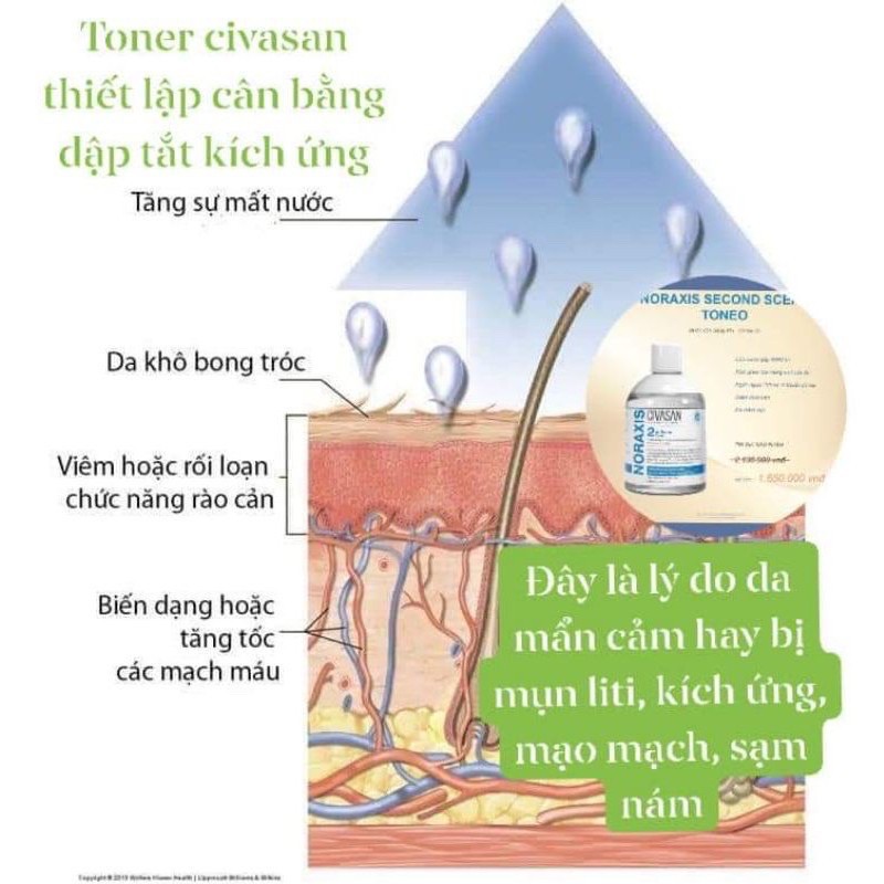 [HCM]Toner Civasan Cấp Nước Phục Hồi Da Mỏng Yếu