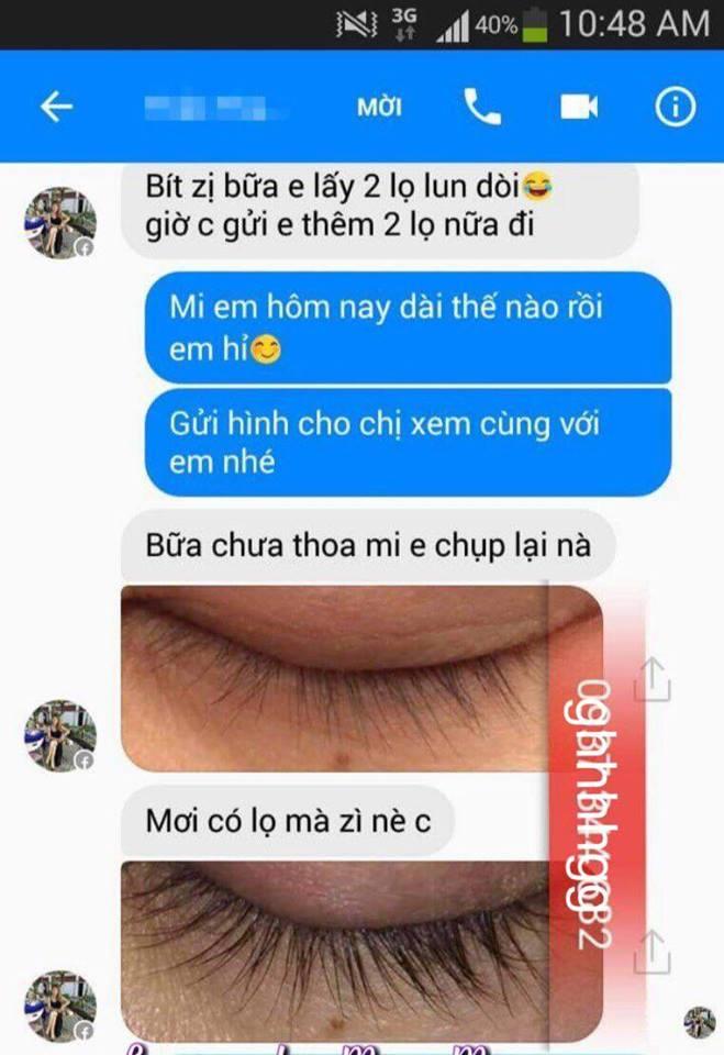 Thuốc mọc lông mày, dài mi Lumigan - Mỹ