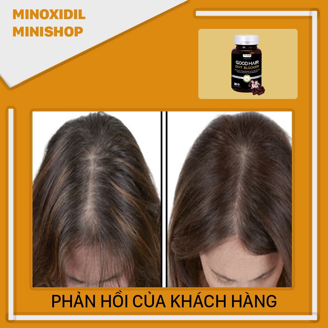 DHT BLOCKER GOOD HAIR MỌC TÓC - NGĂN RỤNG TÓC