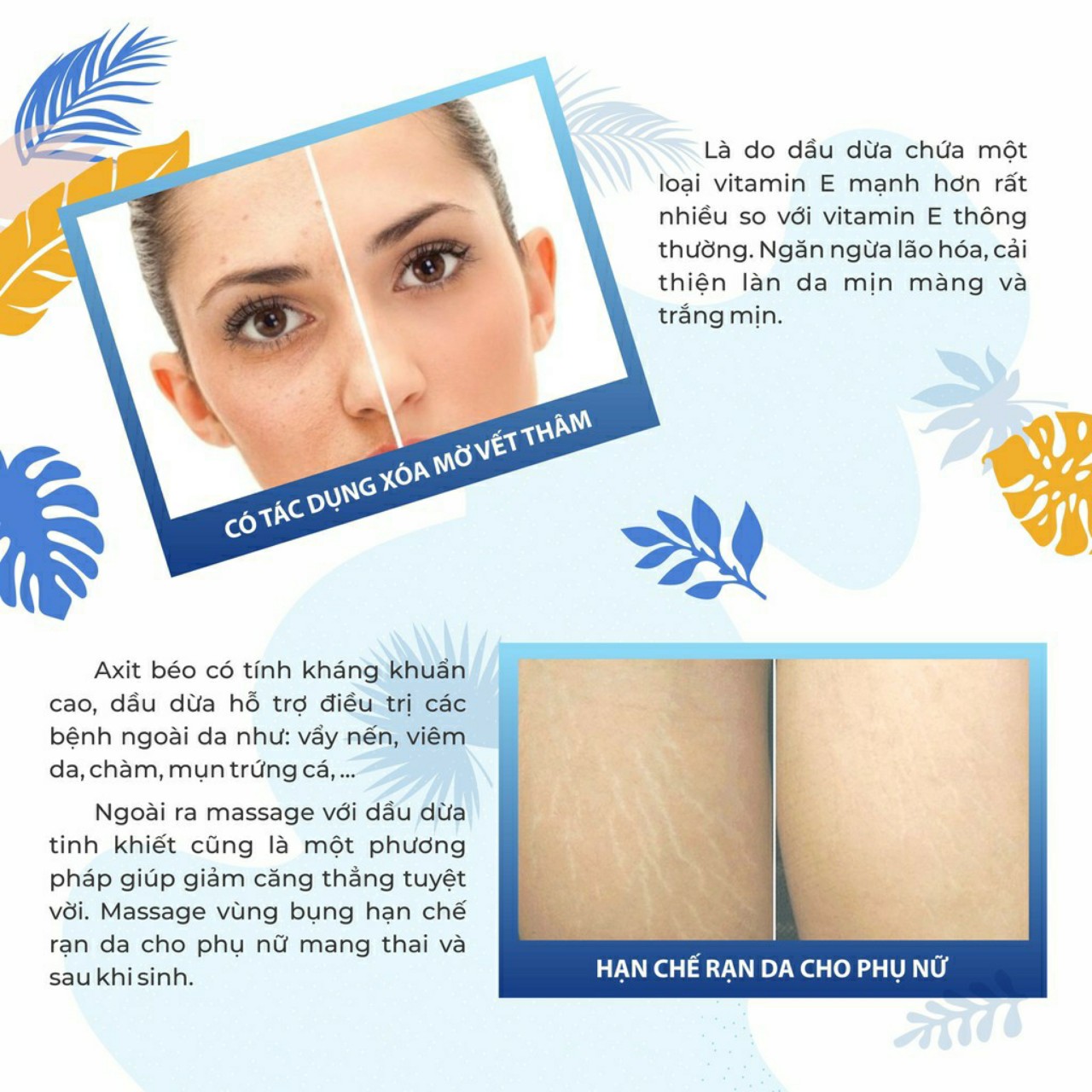 Dầu Dừa Tinh Khiết Dạng Xịt 130ml Vietcoco