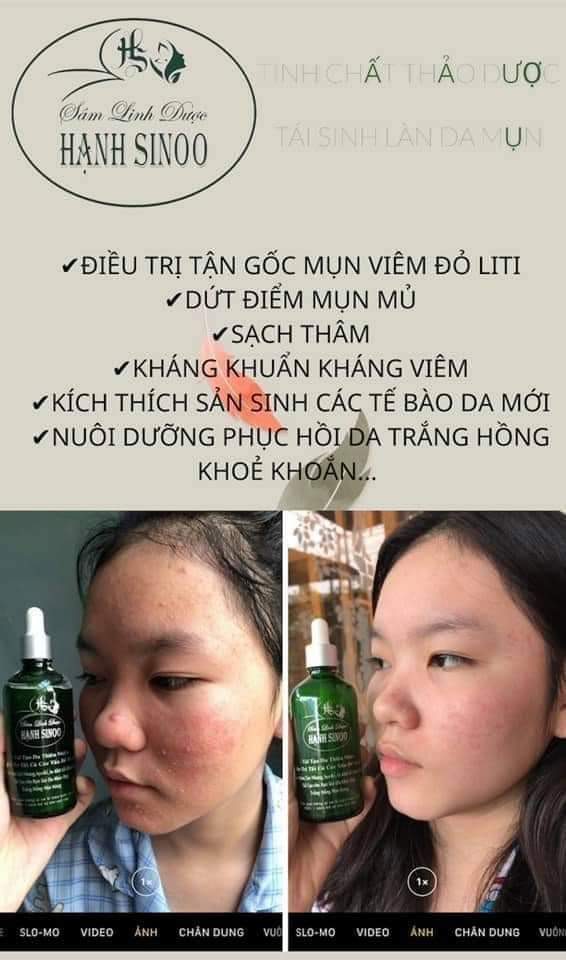 SÂM LINH DƯỢC HẠNH SINOO