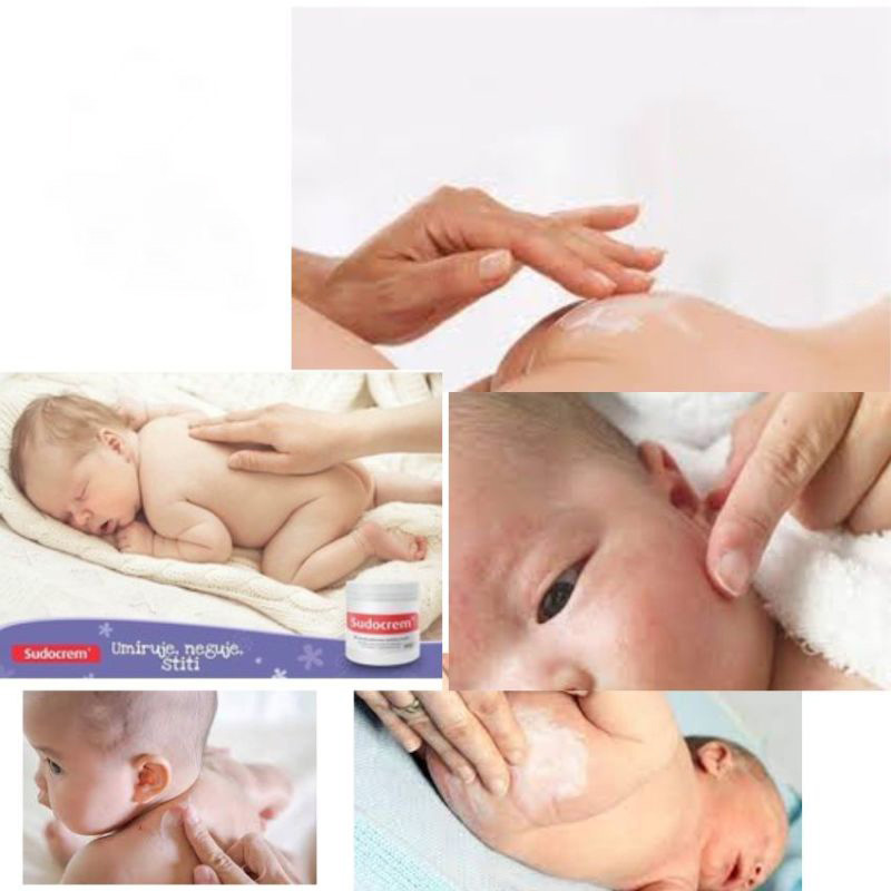 Sudocrem Kem chăm sóc em bé 60g/125g