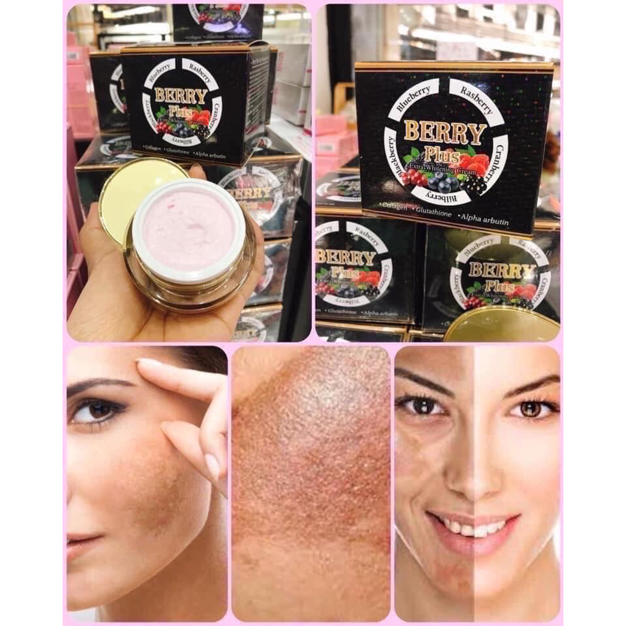 [HCM][Chính hãng] Kem xóa Nám Tàn Nhang Berry Plus Thái Lan
