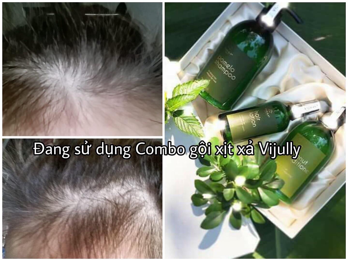 Combo Gội + Tinh dầu bưởi Thiên nhiên 280ml+100ml