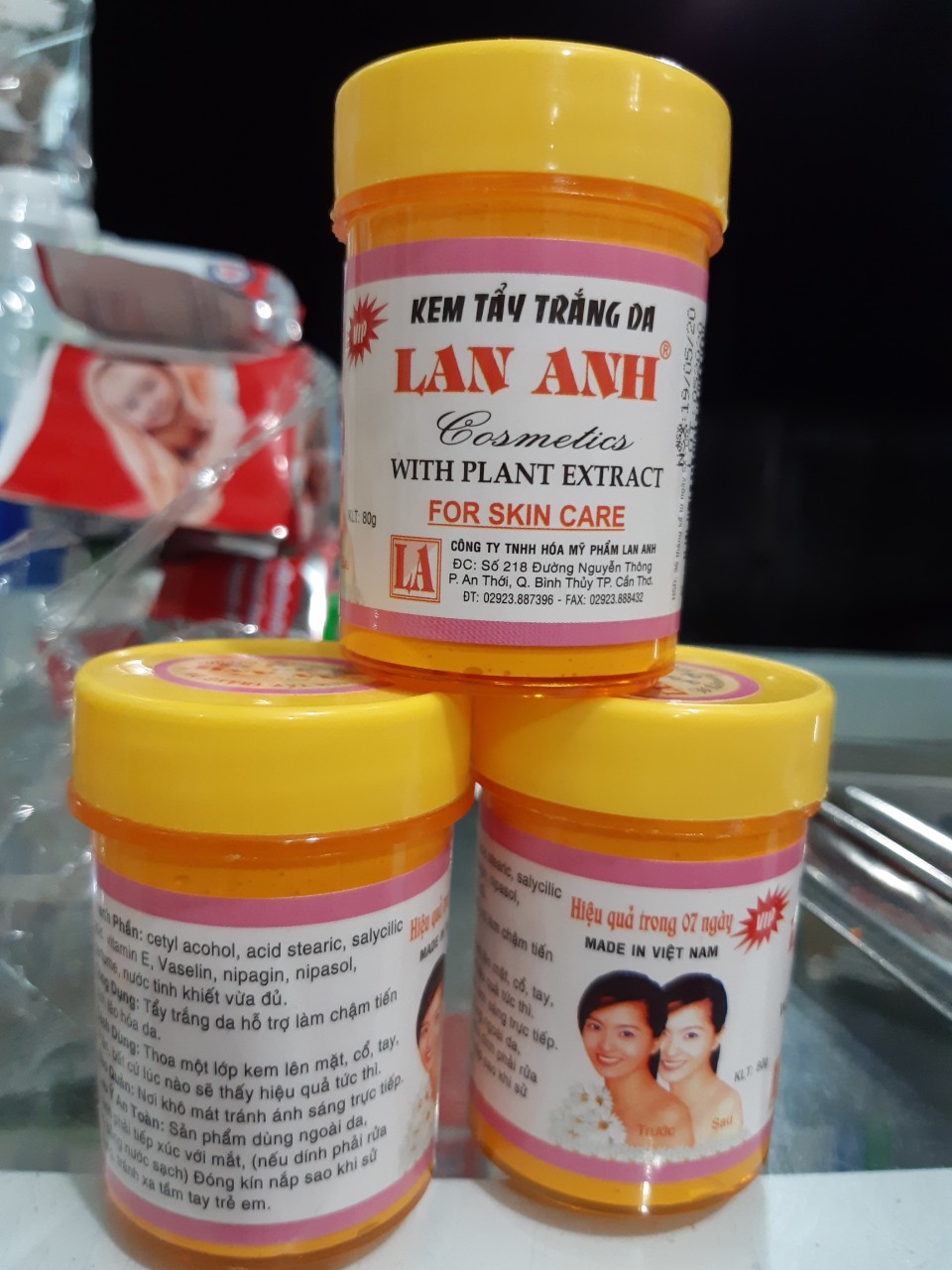 kem tẩy lan anh