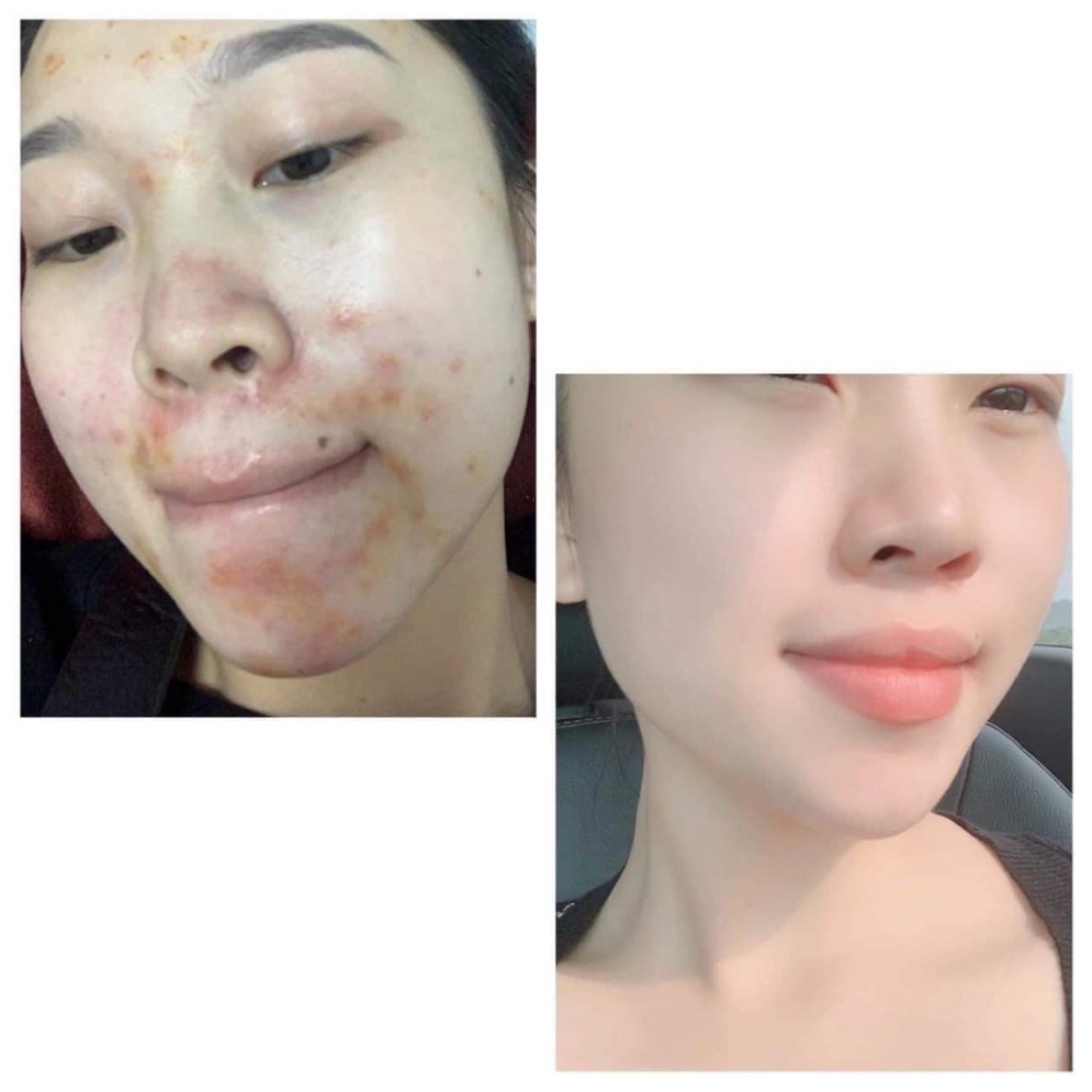 Bột đắp mặt thảo DR CARE PRO