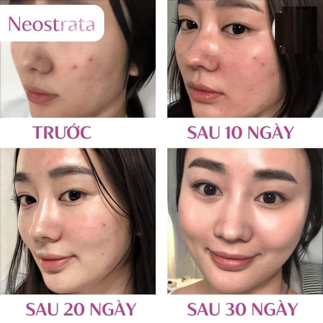 Neostrata Oily Skin Solution Lotion AHA 8% chai full 100ml (chất lỏng)