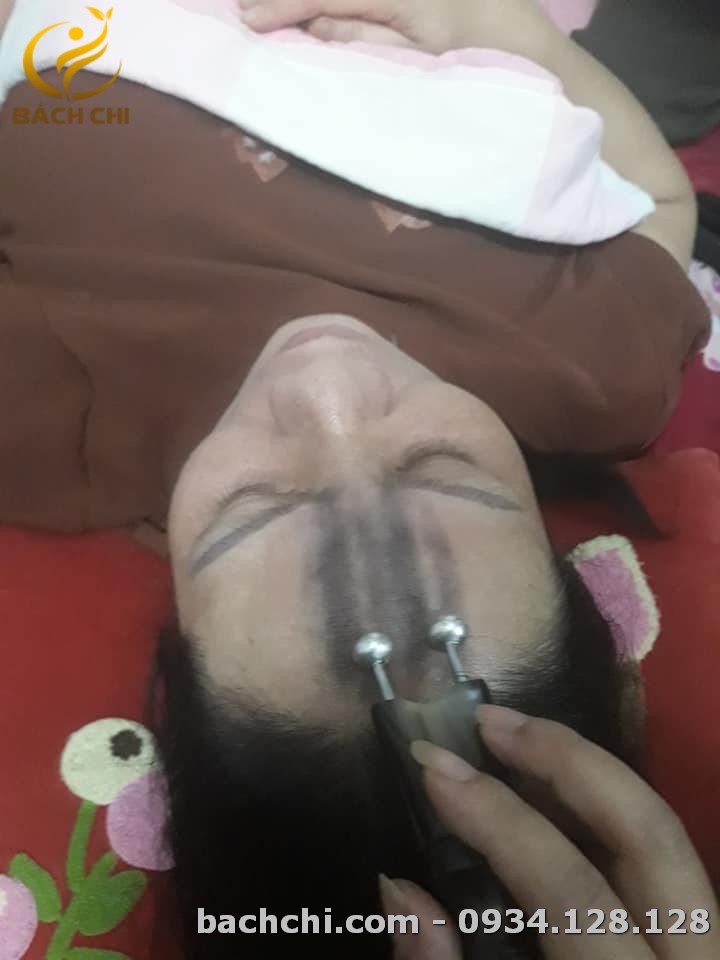 Bọ cạp sừng chân bạc Bách Chi - Đánh gió, giải cảm